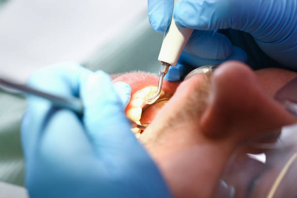 Best Dentist for Tooth Abscess  in Pleasant Hill, IA