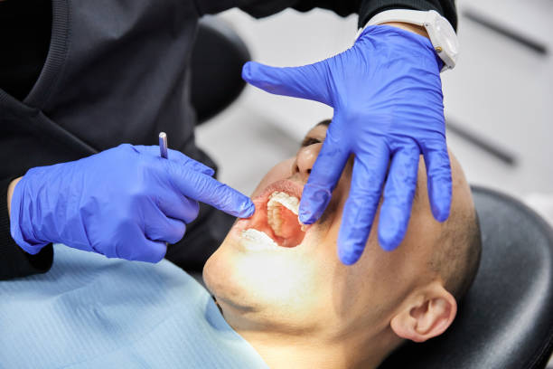 Best Knocked-Out Tooth Emergency  in Pleasant Hill, IA
